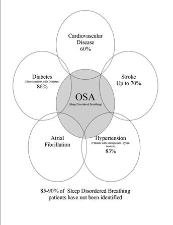 Prevalence of Obstructive Sleep Apnea (OSA)